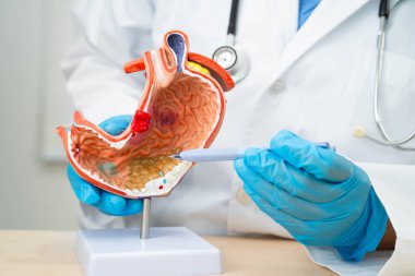 Dispsi ya da mide hastalığı, hastanede teşhis ve tedavi için mide anatomisi modeli tutan doktor..