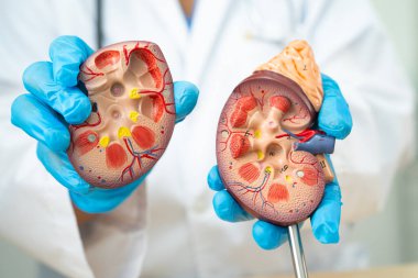 Böbrek hastalığı, Kronik Böbrek Hastalığı, Doktor, hastanede tedavi ve eğitim için insan modeli tutuyor..