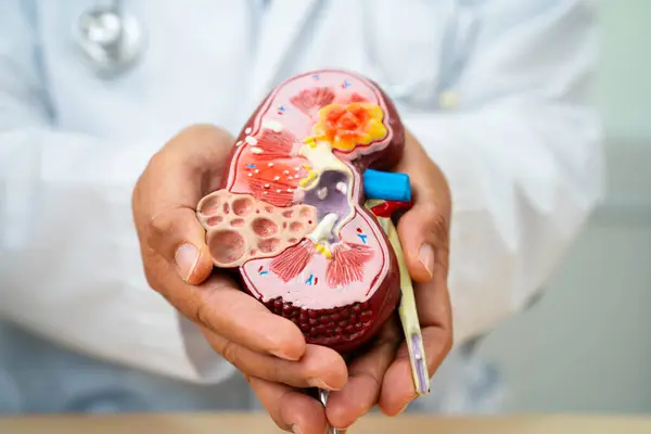 Böbrek hastalığı, Kronik Böbrek Hastalığı, Doktor, hastanede tedavi ve eğitim için insan modeli tutuyor..