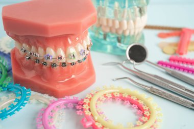 Ortodontik bağlar halkalar ve kravatlar, diş hekimliği üzerine çalışan dişçi için model..