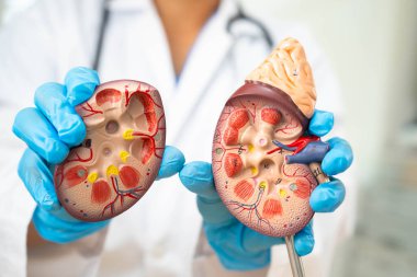 Böbrek hastalığı, Kronik Böbrek Hastalığı, Doktor, hastanede tedavi ve eğitim için insan modeli tutuyor..