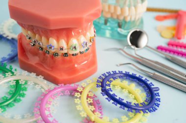 Orthodontic ligatures rings and ties, elastic rubber bands on orthodontic braces, model for dentist studying about dentistry. clipart