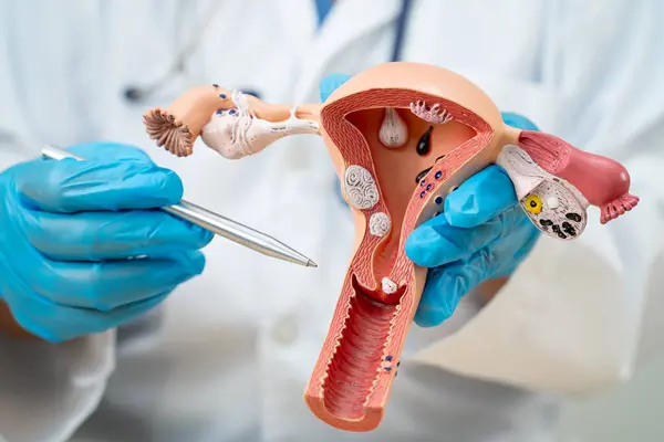 Rahim, hastanede teşhis ve tedavi için anatomi modeli olan bir doktor..