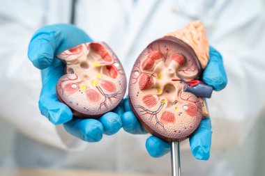 Böbrek hastalığı, Kronik Böbrek Hastalığı, Doktor, hastanede tedavi ve eğitim için insan modeli tutuyor..