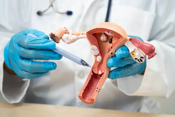 Rahim, hastanede teşhis ve tedavi için anatomi modeli olan bir doktor..