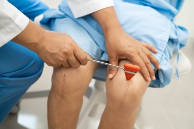 Doktor nörolog çekiçle refleks dizini test ediyor ve Asya 'nın son sınıf yaralarını gösteriyor..