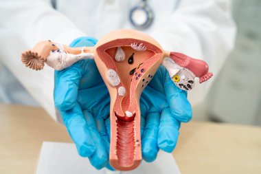 Rahim, hastanede teşhis ve tedavi için anatomi modeli olan bir doktor..