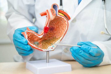 Dispsi ya da mide hastalığı, hastanede teşhis ve tedavi için mide anatomisi modeli tutan doktor..
