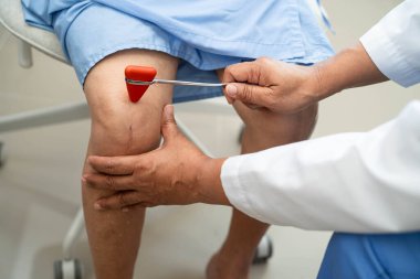 Doktor nörolog çekiçle refleks dizini test ediyor ve Asya 'nın son sınıf yaralarını gösteriyor..