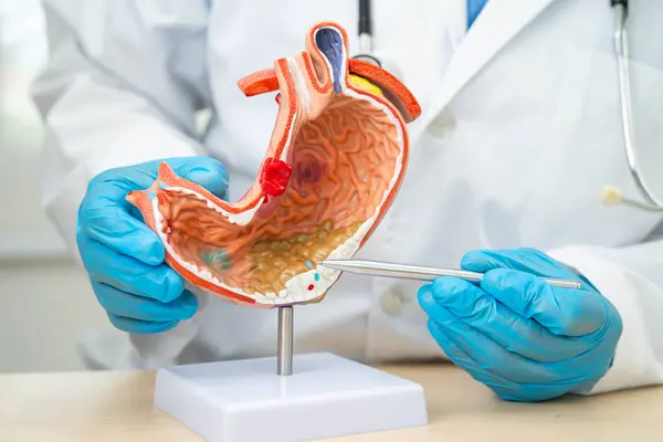 Dispsi ya da mide hastalığı, hastanede teşhis ve tedavi için mide anatomisi modeli tutan doktor..