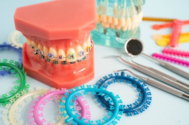 Ortodontik bağlar halkalar ve kravatlar, diş hekimliği üzerine çalışan dişçi için model..