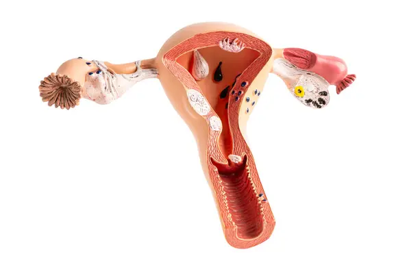 İnsan rahim modeli beyaz arkaplanda kardiyovasküler hastalık CVD ile izole edilmiştir..