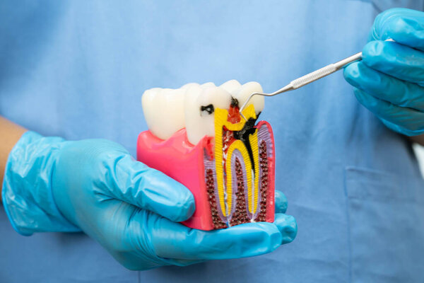 Dentist use dental instrument to check artificial tooth roots dental implant into jaw, Root canal model.