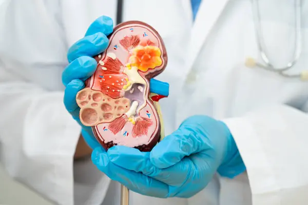 Böbrek hastalığı, Kronik Böbrek Hastalığı, Doktor, hastanede tedavi ve eğitim için insan modeli tutuyor..