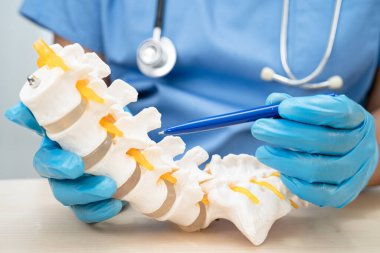 Doktor, ortopedi bölümünde tedavi için bel omurgası iskeleti ve omurga siniri ile yerinden çıkmış disk parçasını tutuyor..