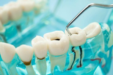 Diş hekimi diş ve sakızları ağızda tedavi etmek için diş aleti kullanır.