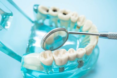 Diş hekimi diş ve sakızları ağızda tedavi etmek için diş aleti kullanır.