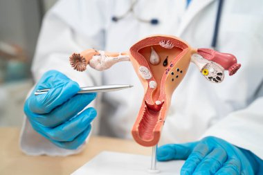 Rahim, hastanede teşhis ve tedavi için anatomi modeli olan bir doktor..
