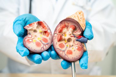 Böbrek hastalığı, Kronik Böbrek Hastalığı, Doktor, hastanede tedavi ve eğitim için insan modeli tutuyor..