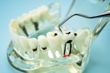 Diş hekimi diş ve sakızları ağızda tedavi etmek için diş aleti kullanır.