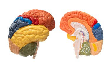 Hastanede teşhis ve tedavi için beyin anatomisi modeli, Alzheimer hastalığı.