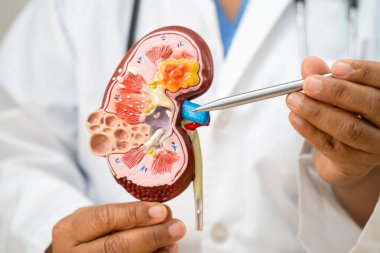 Böbrek hastalığı, Kronik Böbrek Hastalığı, Doktor, hastanede tedavi ve eğitim için insan modeli tutuyor..