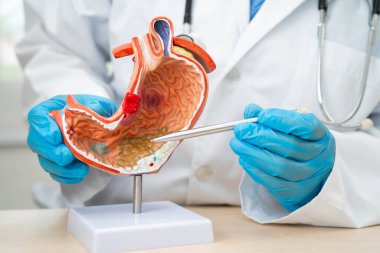 Dispsi ya da mide hastalığı, hastanede teşhis ve tedavi için mide anatomisi modeli tutan doktor..