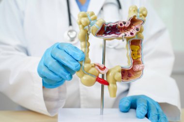 Bağırsak, hastanede teşhis ve tedavi için insan anatomisi modeli tutan doktor..