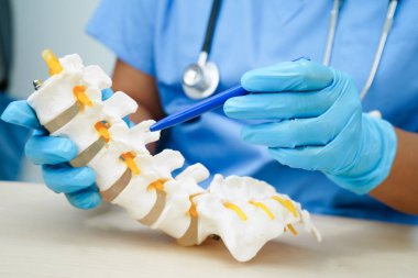 Omurga ve kemik modeli taşıyan Asyalı doktor, ortopedi bölümünde tedavi için bel kemiği yerinden oynamış disk parçası..
