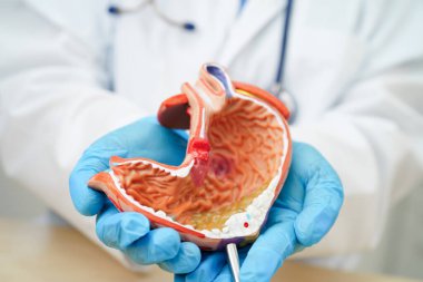 Mide hastalığı, hastanede teşhis ve tedavi için anatomi modeli tutan bir doktor..