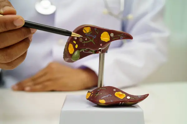 Dünya Hepatit Günü 'nde siroz, karaciğer kanseri, yağlı karaciğer, karaciğer anatomisi olan Asyalı doktor..