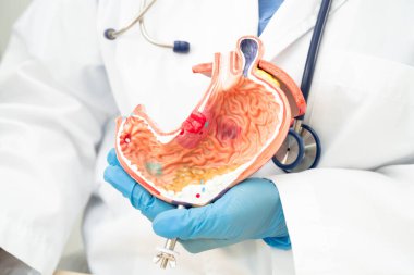 Mide hastalığı, hastanede teşhis ve tedavi için anatomi modeli tutan bir doktor..