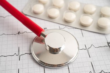 Elektrokardiyogram, EKG, kalp dalgası, kalp krizi, kardiyogram raporu.