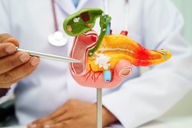 Pankreas iltihabı, pankreas hastası Asyalı doktor, safra kesesi ve safra kesesi insan anatomisi modeli..