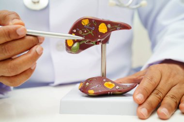 Dünya Hepatit Günü 'nde siroz, karaciğer kanseri, yağlı karaciğer, karaciğer anatomisi olan Asyalı doktor..