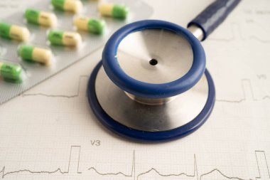 Elektrokardiyogramda stetoskop. Uyuşturucu, kalp dalgası, kalp krizi, kardiyogram raporu..