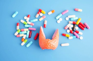 İlaç tedavisi gören tiroid modeli, Hipertiroidizm, Aşırı Aktif veya Lenfoma.