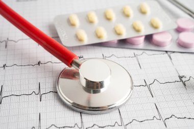 Elektrokardiyogram, EKG, kalp dalgası, kalp krizi, kardiyogram raporu.