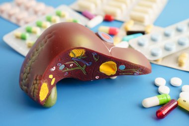 Hap tedavisi gören karaciğer modeli, siroz, karaciğer kanseri, yağlı karaciğer..