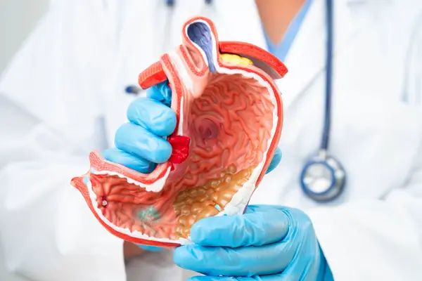 Mide hastalığı, hastanede teşhis ve tedavi için anatomi modeli tutan bir doktor..