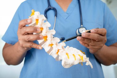 Omurga ve kemik modeli taşıyan Asyalı doktor, ortopedi bölümünde tedavi için bel kemiği yerinden oynamış disk parçası..