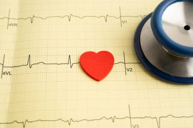 Elektrokardiyogram, EKG, kalp dalgası, kalp krizi, kardiyogram raporu.