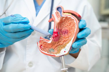 Mide hastalığı, hastanede teşhis ve tedavi için anatomi modeli tutan bir doktor..