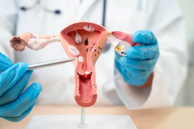 Rahim, hastanede teşhis ve tedavi için insan anatomisi modeli tutan doktor..