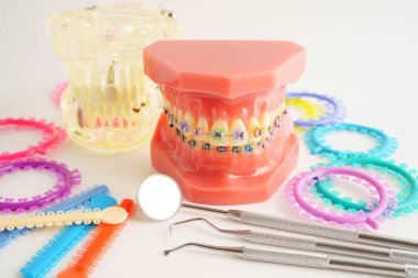 Ortodontik bağlar halkalar ve kravatlar, diş hekimliği üzerine çalışan dişçi için model..
