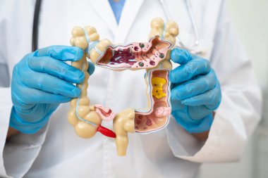Bağırsak, hastanede teşhis ve tedavi için insan anatomisi modeli tutan doktor..