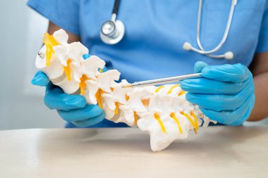 Omurga ve kemik modeli taşıyan Asyalı doktor, ortopedi bölümünde tedavi için bel kemiği yerinden oynamış disk parçası..
