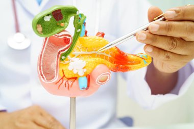 Pankreas iltihabı, pankreas hastası Asyalı doktor, safra kesesi ve safra kesesi insan anatomisi modeli..