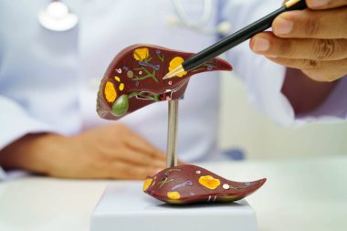 Dünya Hepatit Günü 'nde siroz, karaciğer kanseri, yağlı karaciğer, karaciğer anatomisi olan Asyalı doktor..
