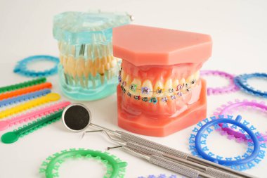 Ortodontik bağlar halkalar ve kravatlar, diş hekimliği üzerine çalışan dişçi için model..